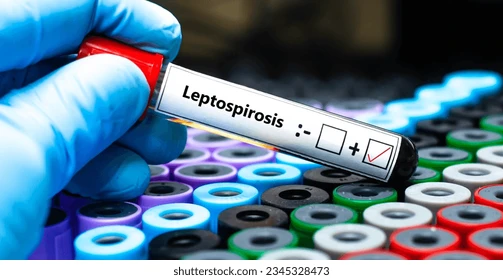 Waspada, Ancaman Leptospirosis Selama Musim Pancaroba